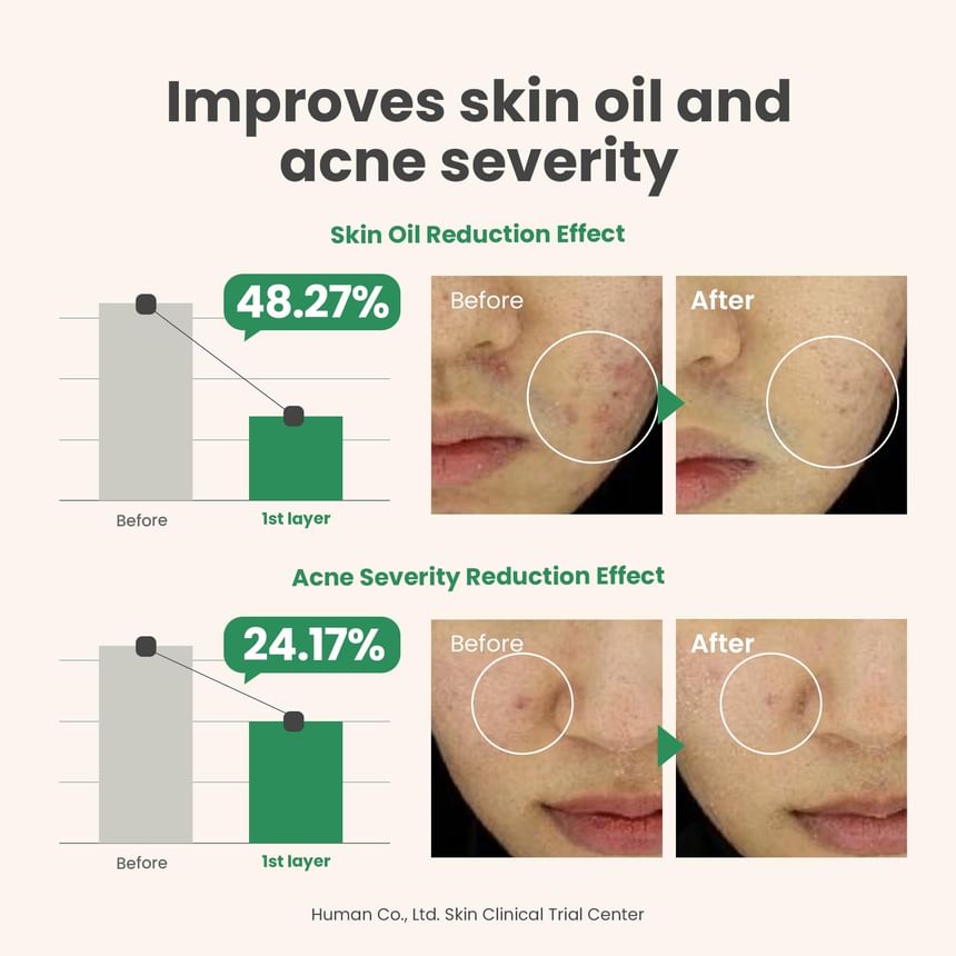 AXIS-Y - Spot The Difference Blemish Treatment 15ml  5