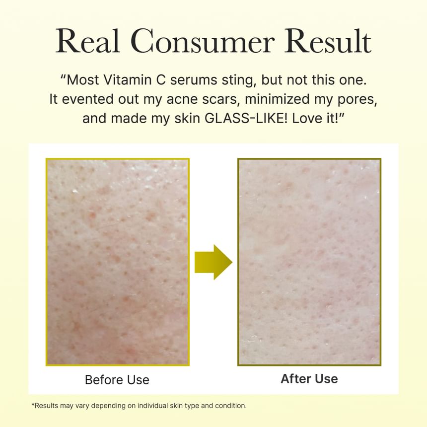 Arencia - Vitamin C Booster Shot Mini 10ml 6