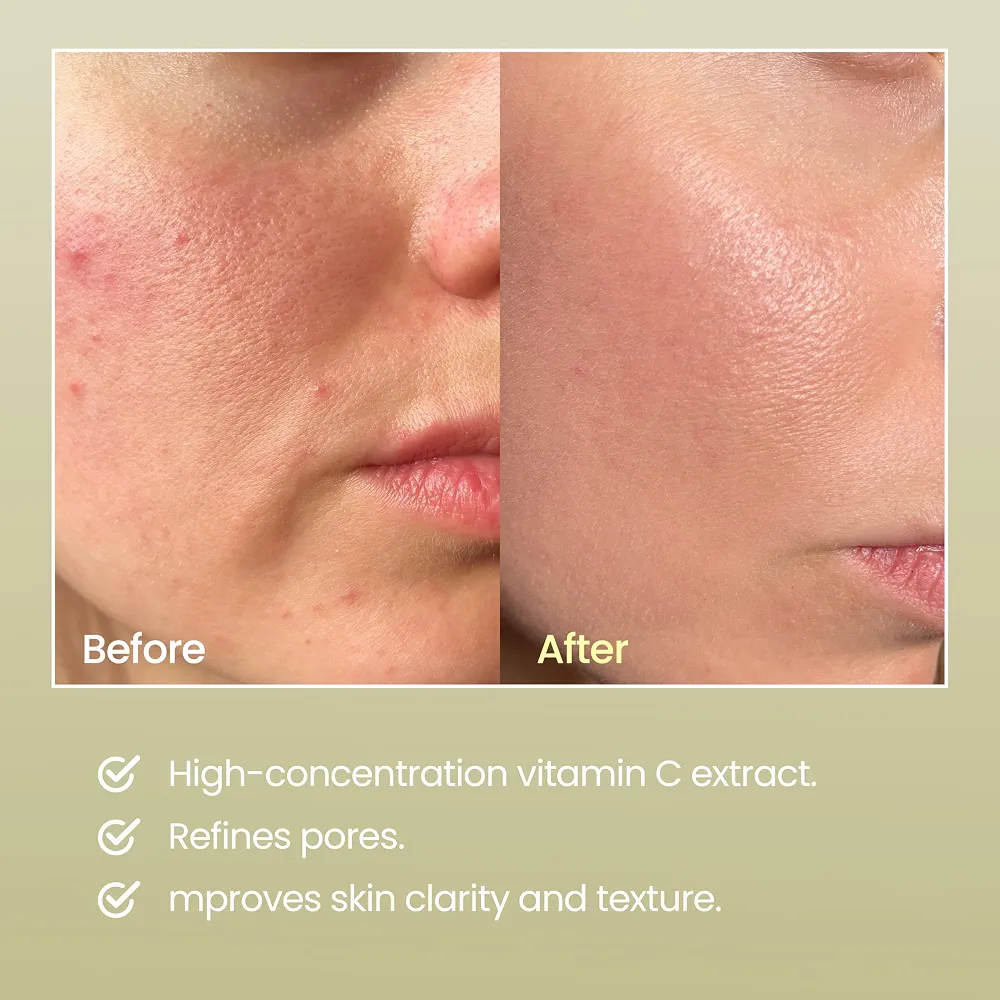 NEOGEN - Dermalogy Real Vita C Serum 32gm 3