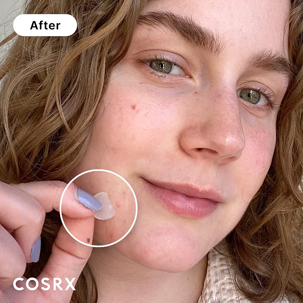 COSRX - Acne Pimple Master Patch 24 Patches 6