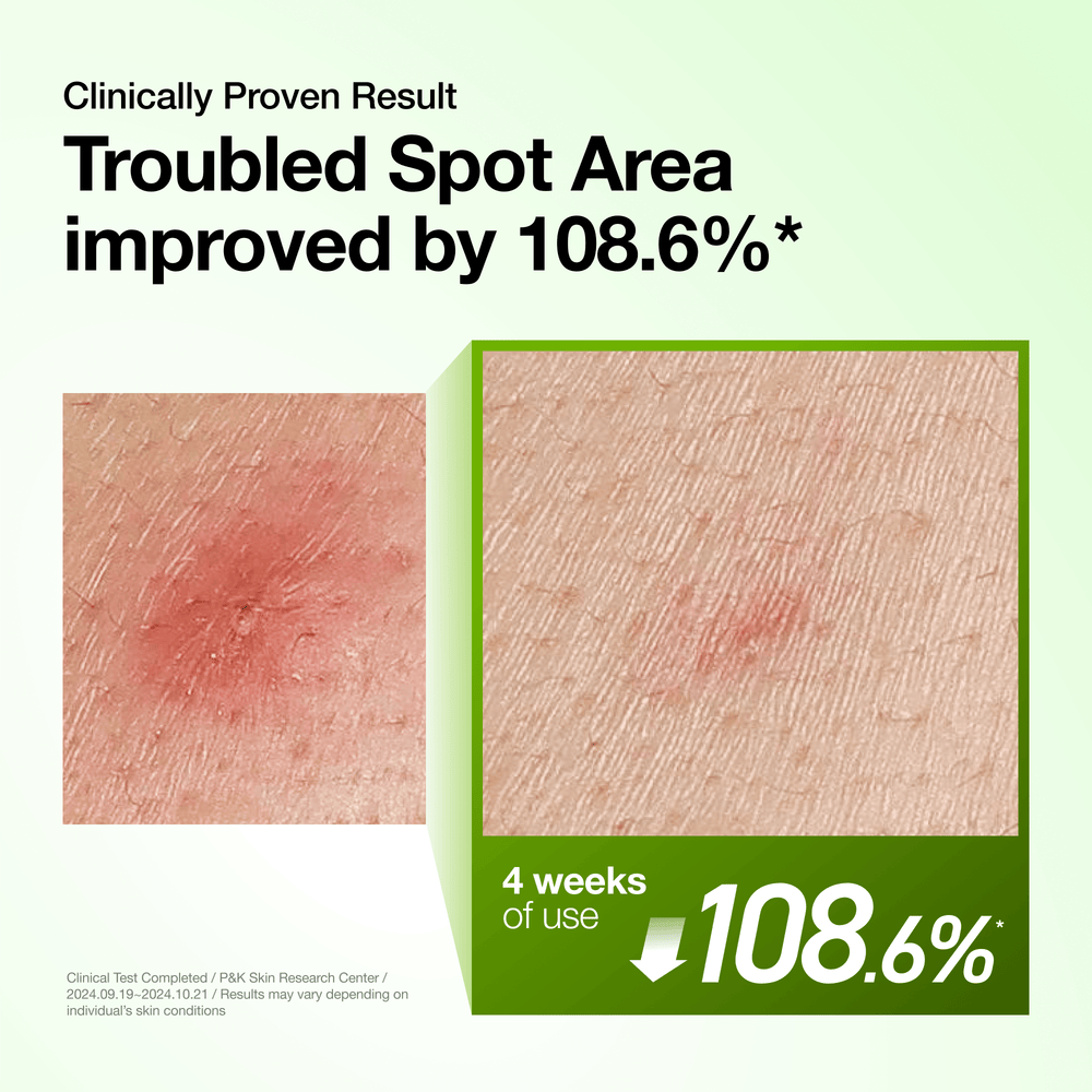 Anua - Azelaic Acid 10 Hyaluron Redness Soothing Serum Mini 10ml 4