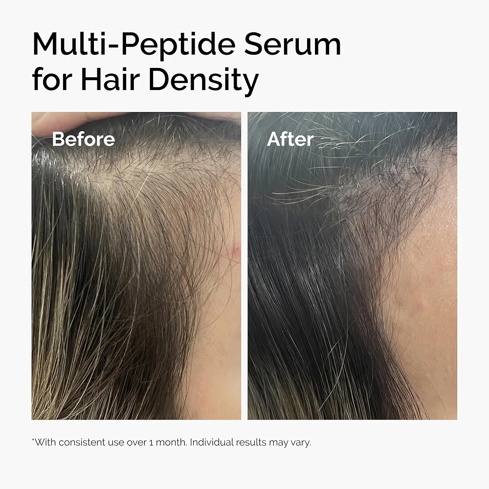 The Ordinary Multi-Peptide Serum for Hair Density 60ml 5