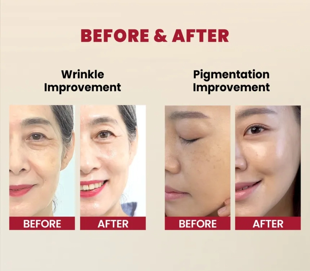 KSECRET - SEOUL 1988 Serum : Retinal Liposome 2% + Black Ginseng 30ml  4