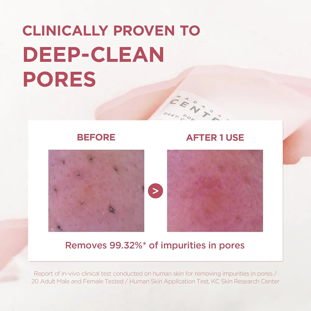 SKIN1004 - Madagascar Centella Poremizing Deep Cleansing Foam 125ml 3