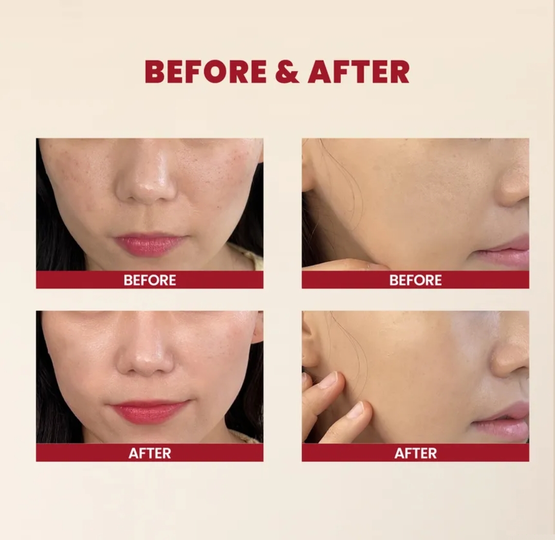 KSECRET - SEOUL 1988 Essence : Snail Mucin 97% + Rice 100ml 5