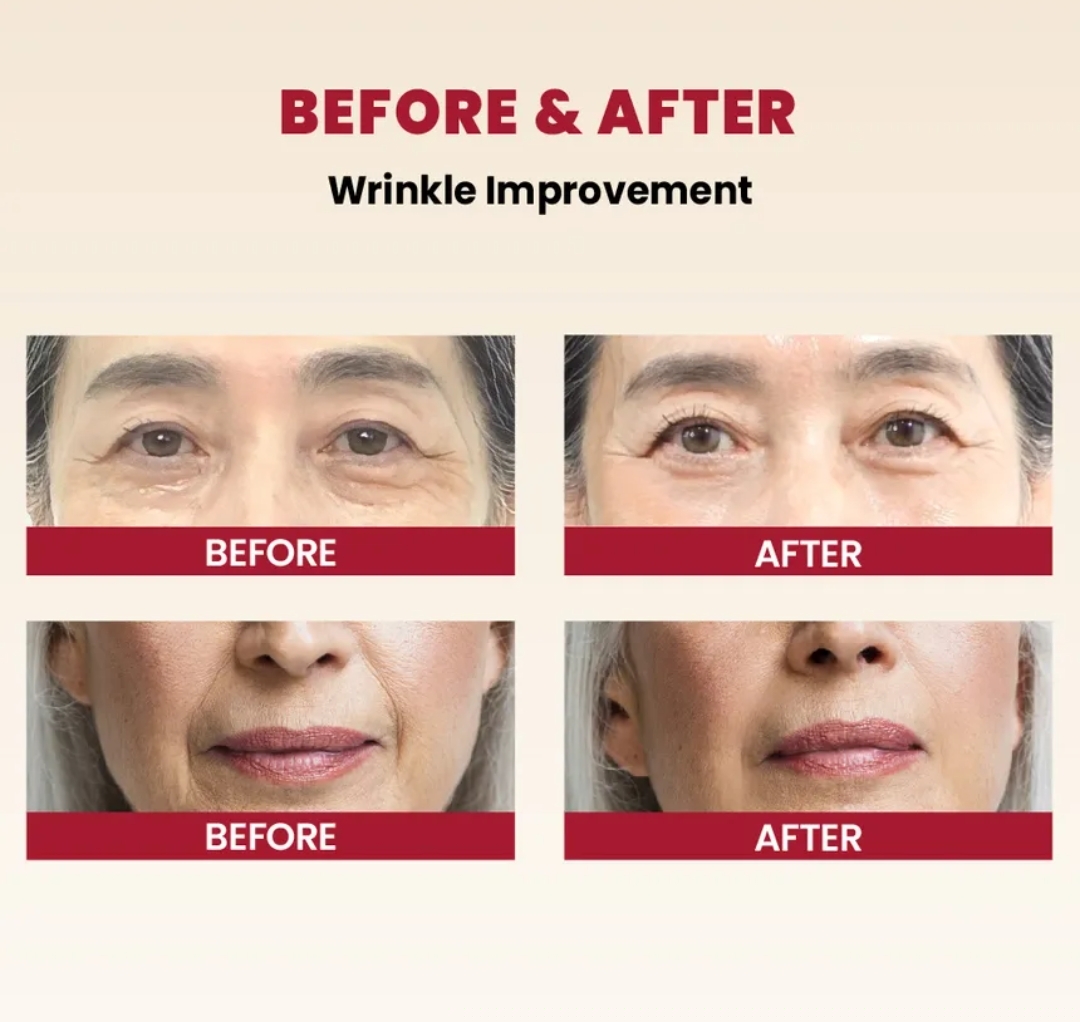 KSECRET - SEOUL 1988 Cream : Retinal Liposome 1% + Fermented Rice 50ml 5