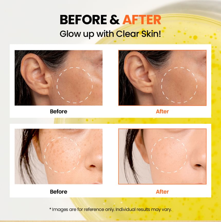 KSECRET - SEOUL 1988 Glow Serum : Niacinamide 15% + Yuja 30ml 10