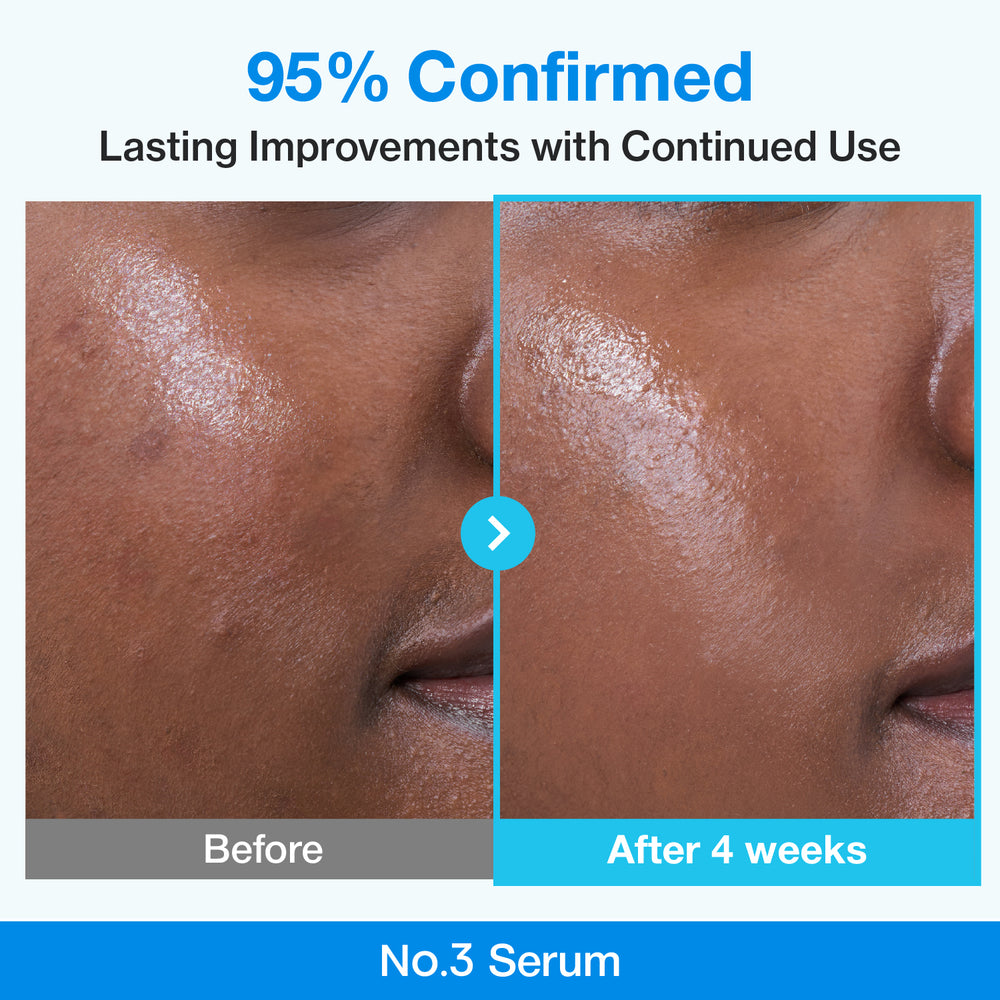 numbuzin - No.3 Blue Bio-Retinol Pore Refining Serum 30ml  5