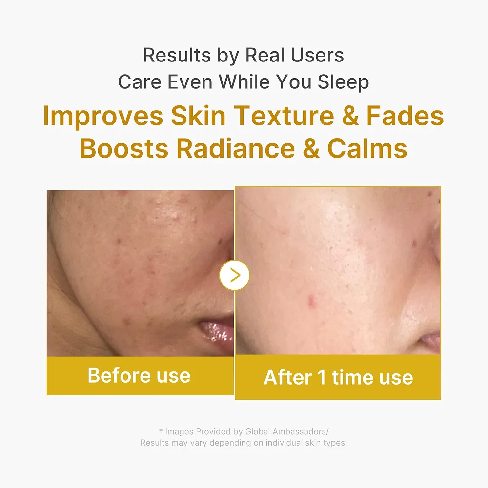 medicube - Kojic Acid Turmeric Night Wrapping Mask 75ml 5
