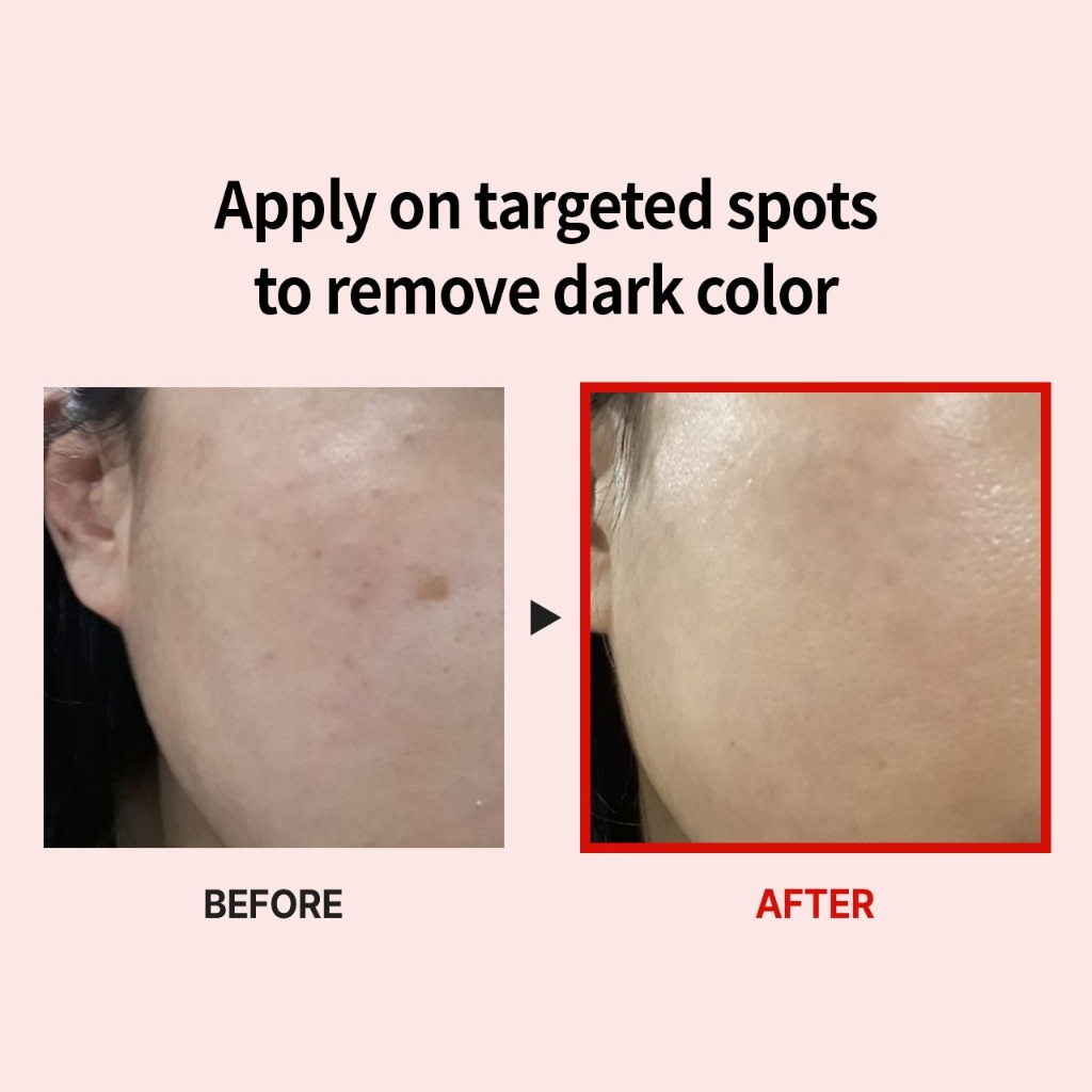 MEDIPEEL - Melanon X Cream 30ml 6