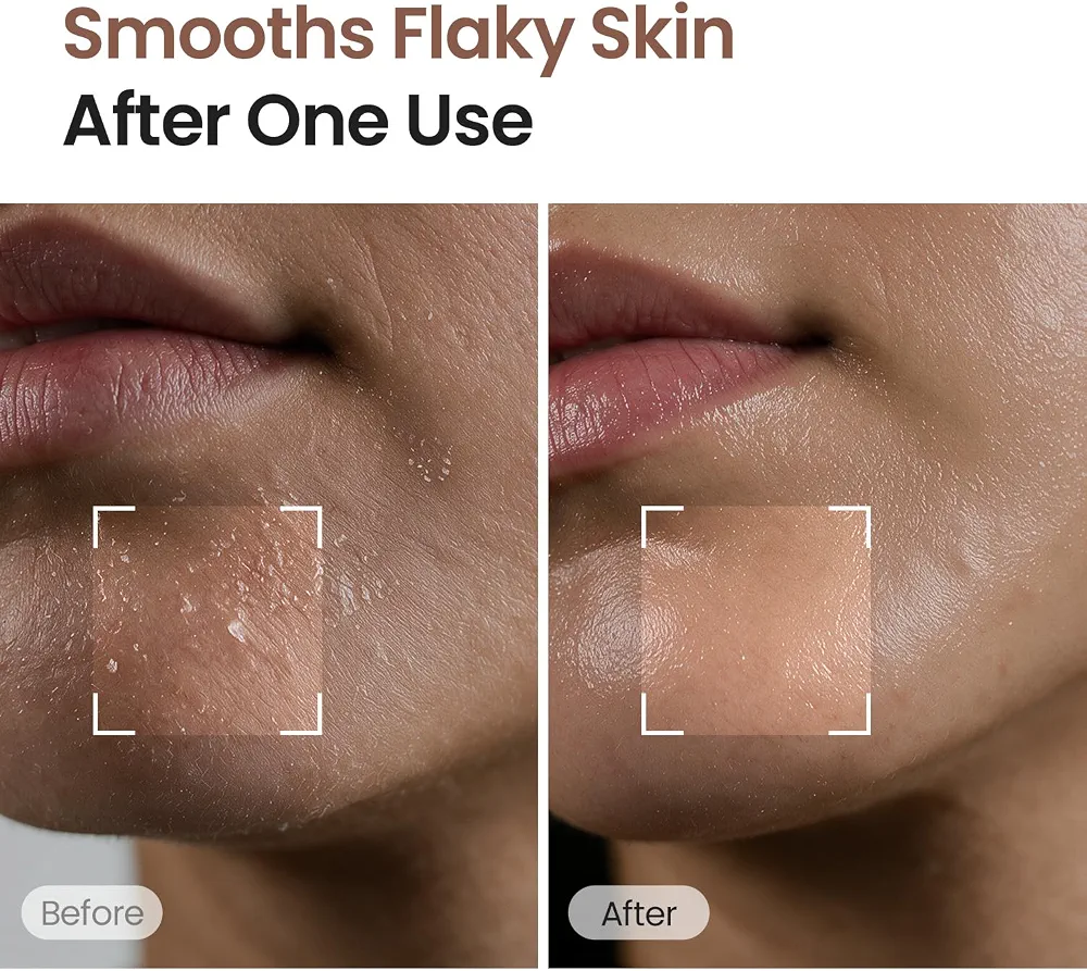SKINFOOD - Black Sugar Mask Wash Off 100g 3